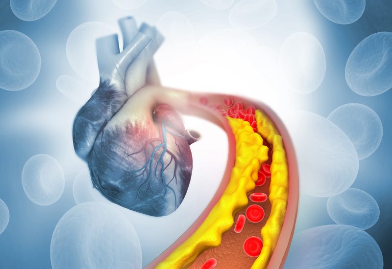 Was ist Cholesterin – und warum kann ein zu hoher Wert gefährlich sein?