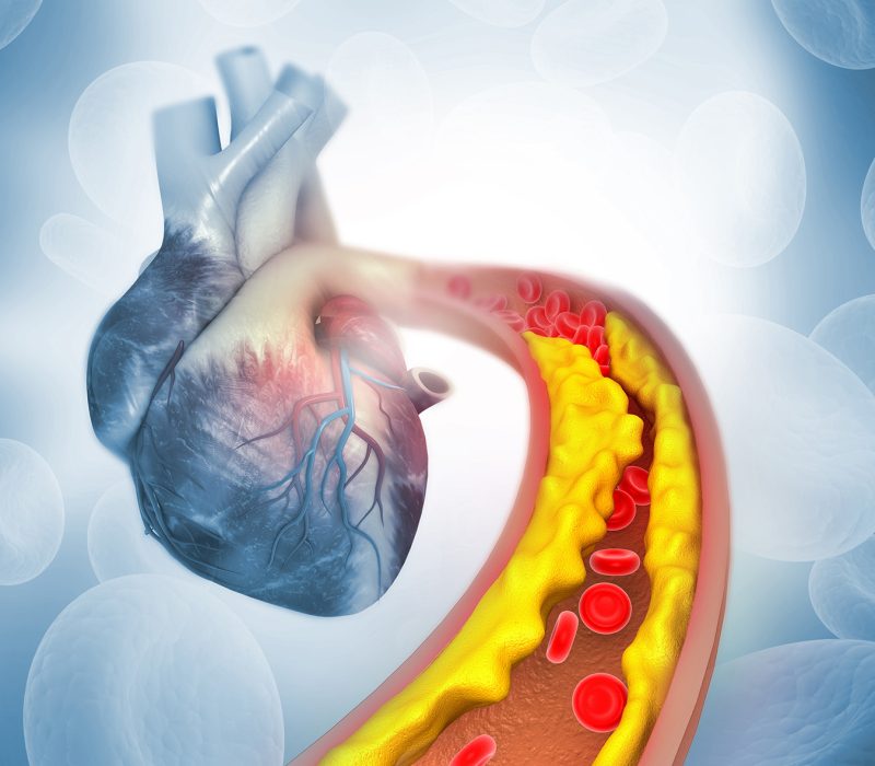 Was ist Cholesterin – und warum kann ein zu hoher Wert gefährlich sein?